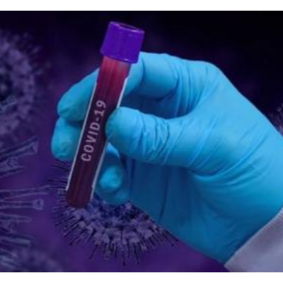 乌克兰应成为第一批购买COVID-19疫苗的国家